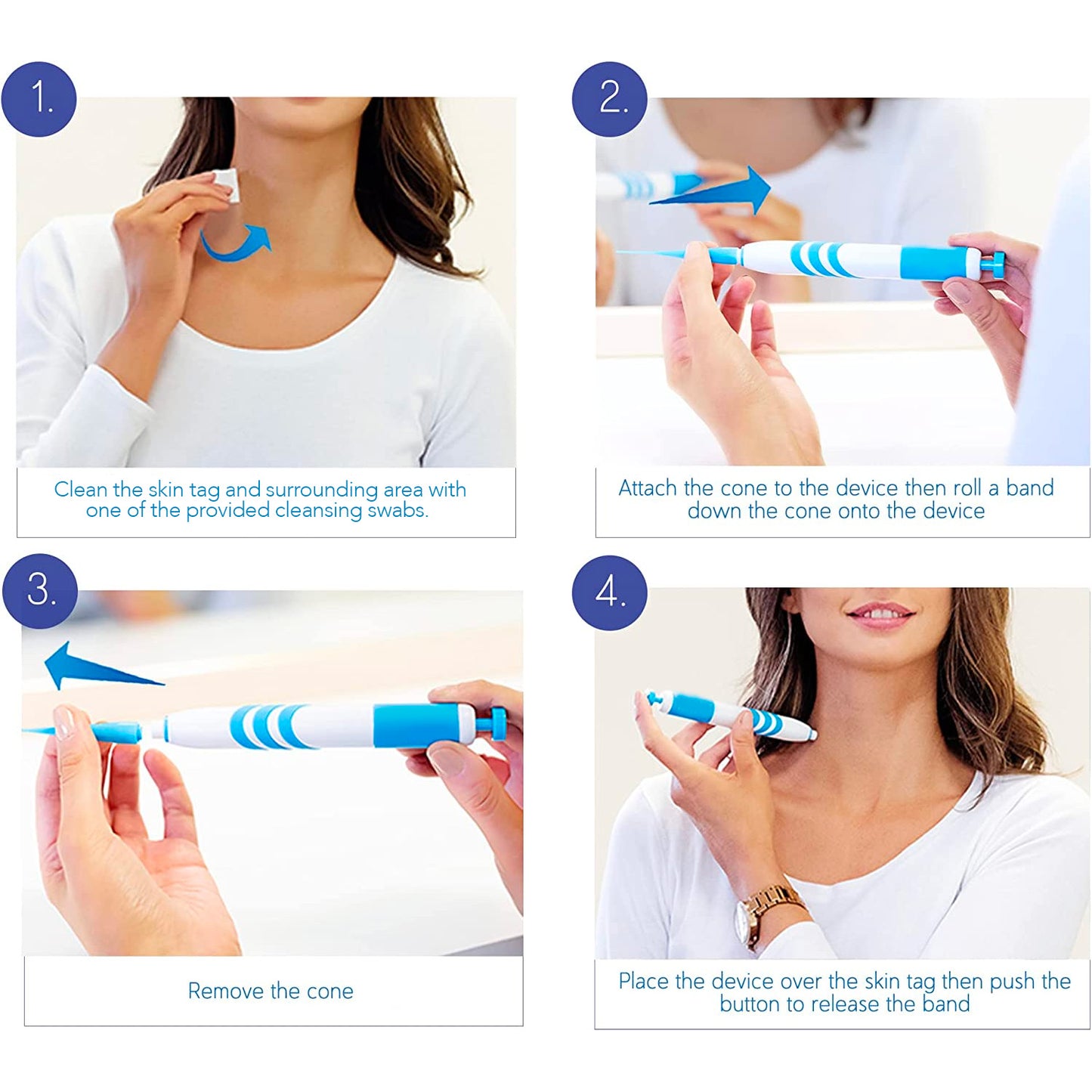 Auto STR Skin Tag Removal Kit. Fast Effective & Safe Skin Tag Remover for Medium/Large Skintags (0.16-0.25in / 4-6mm) - One-Hand Application in Minutes, Includes Pen, Loading Cone, 10 Bands & 10 Wipes